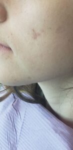 Facial features at completion.