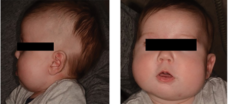 B. Left: Placement
of the appliance.
Right: Removal of
the appliance.