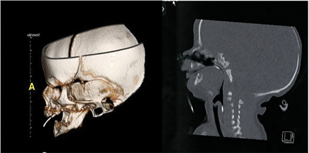 C. Pre-operative CT scan.