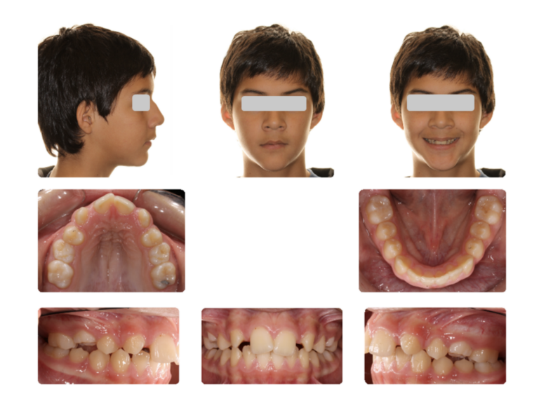 Pre-treatment intra and extra-oral image.