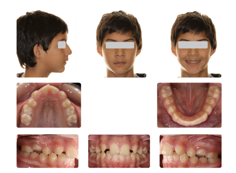 Pre-treatment intra and extra-oral image. 