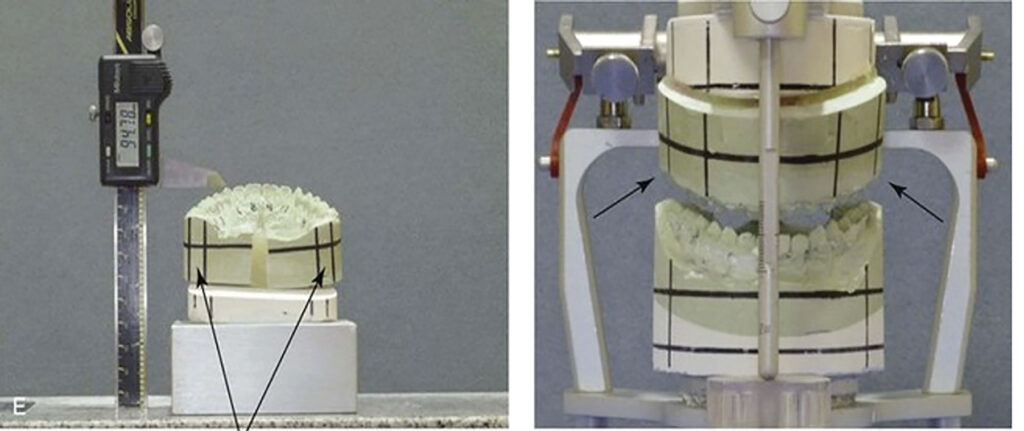 Traditional model surgery involving a semi-adjustable articulator, stone models, and manual surgical movements of the casts