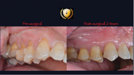 Pre Surgical and Post Surgical Views.