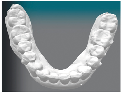 Initial and final digital intra-oral scans.