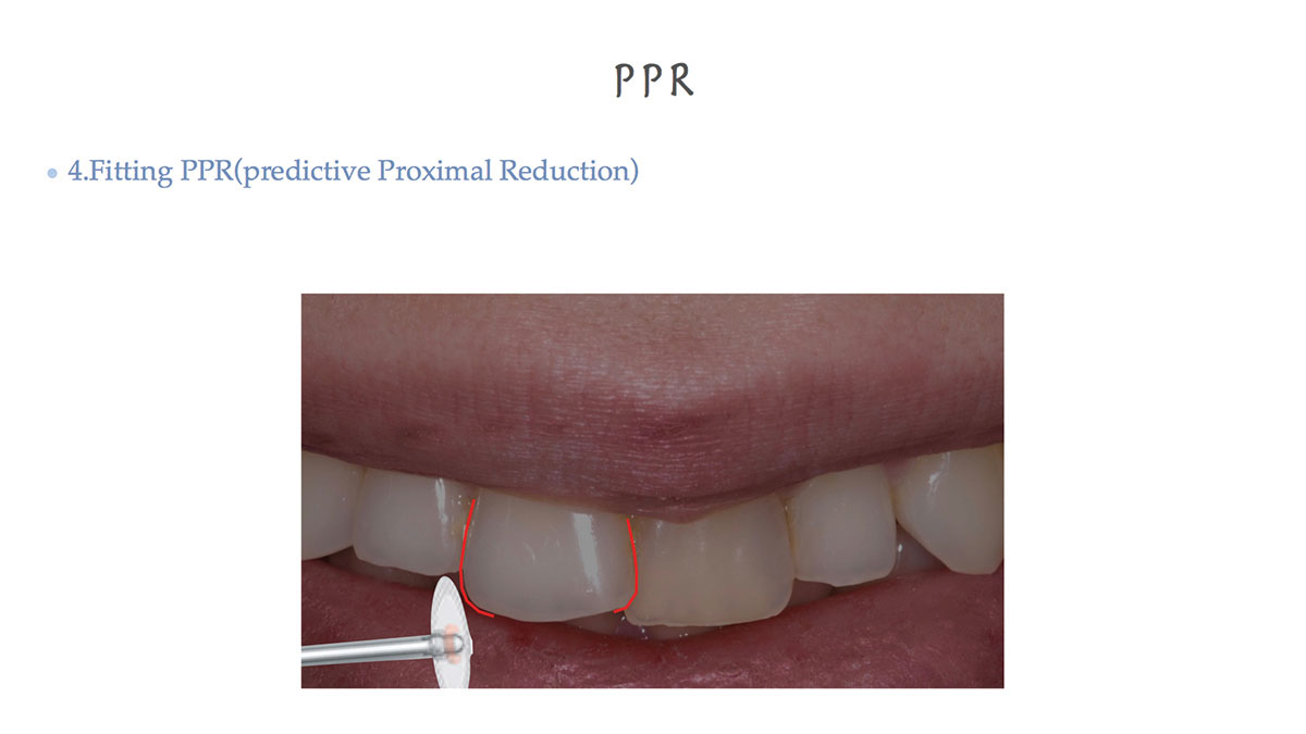 Ppr Rectification image43 - Oral Health Group