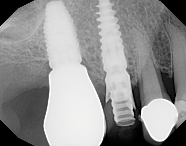 Final surgical radiograph.