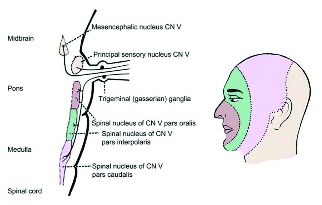 Brainstem Anatomy of Facial Pain Sensation