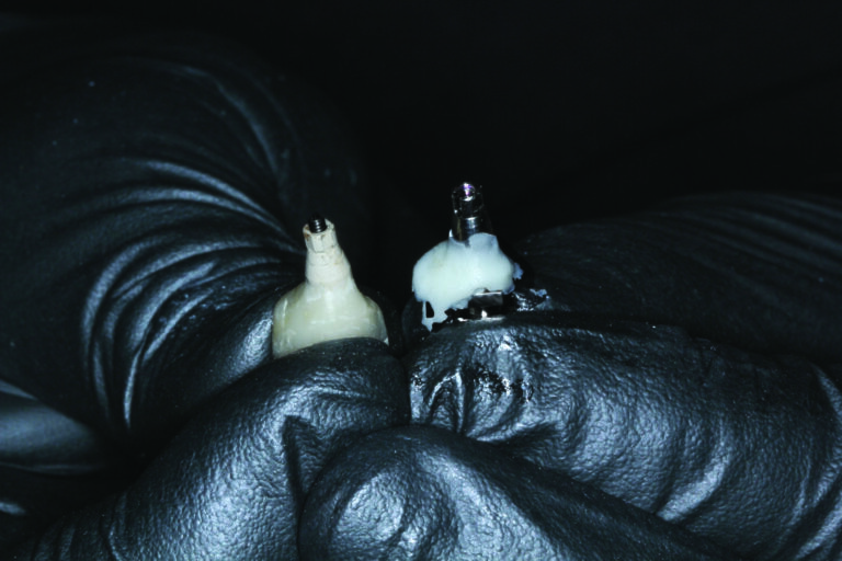 Comparison for emergence.