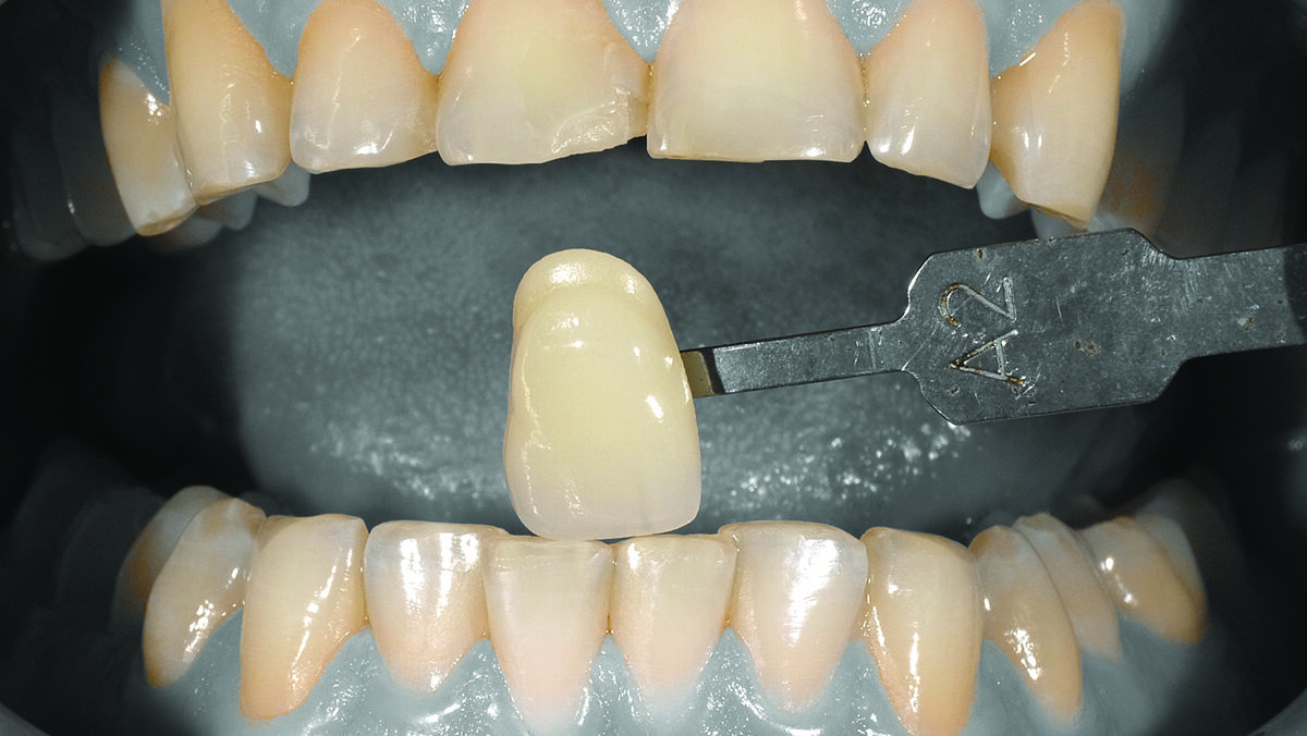 Conservative and Necessary: How Occlusion Can Effect a Single 