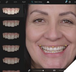 Digital smile using the Smile Cloud system.