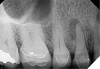 Case 2 by Dr. Brett E. Gilbert