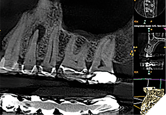Case 2 by Dr. Brett E. Gilbert