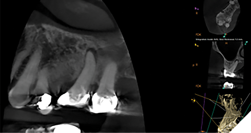 Case 4 by Dr. Brett E. Gilbert