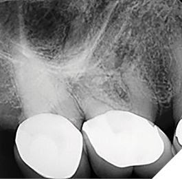 Case 4 by Dr. Brett E. Gilbert