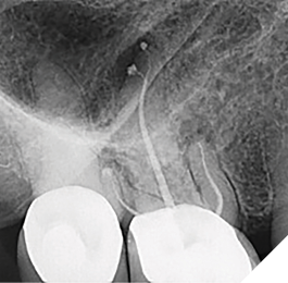 Case 4 by Dr. Brett E. Gilbert