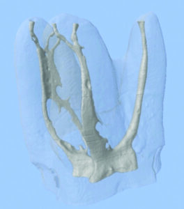 Micro-CT images of a maxillary molar demonstrate the root canal complexity. (Courtesy Dr. Ronald Ordinola Zapata, Brazil.)