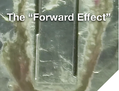 This isthmus block shows the Forward Effect that occurs because NaOCl is being drawn straight out the end of the blunt-cut cannula. EV only irrigates to the depth the micro-cannula fits in the canal, requiring a larger apical shape.