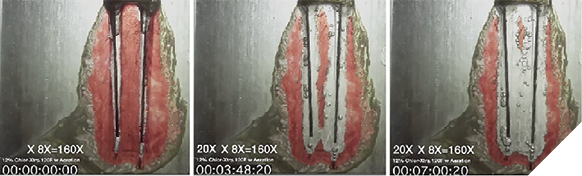 Isthmus research blocks showing the isthmus pulp replica completely dissolved in 7 minutes with higher NaOCl concentrations, temperatures, and continuous agitation from aeration bubbles.