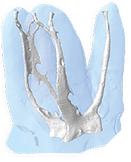 MicroCT reconstruction of an upper first molar, highlighting the complexity of the MB canal system.