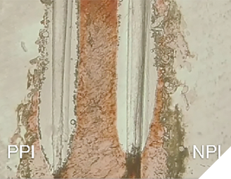 Isthmus research blocks showing no difference between PPI and NPI when constant irrigation was done (Buchanan).