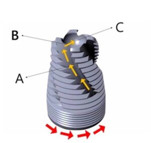 The threaded OsseoFuse® SinusFuse® implant, which is designed specifically for placement under the sinus membrane, incorporates multiple reverse helical lateral cuts that shaves the autogenous bone (shown in yellow arrows) during insertion. As the implant fixture self-taps into the bone with a clockwise movement, it automatically moves the autogenic particles apically to the concave reservoir at the implant apex.