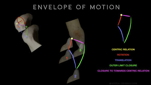 Envelope of motion diagram.