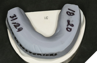 Segmented matrix mandibular teeth 37, 35, 45, 47 only.