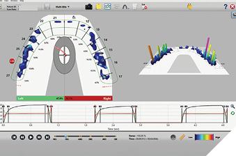 T scan of equilibration.
