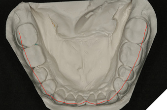 Mandibular occlusal arch form.