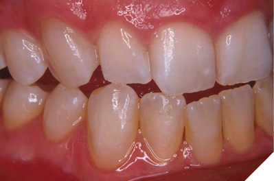 Clinical case (A) Before and (B) After.