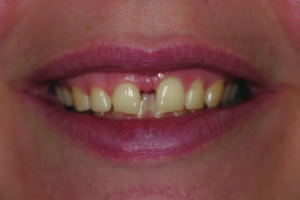 Smile, close-up.