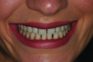 Smile, close-up.