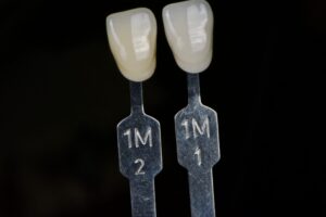 Documentation of shade tabs included in the clinical photograph.