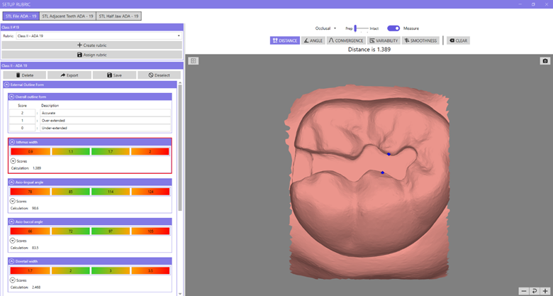 Rubric Class II: Example of a rubric setup for a Class II cavity preparation on Tooth #19 (ADA) [#36 (FDI)]. Two blue points on the occlusal view indicate an isthmus width of 1.389 mm. The software automatically generates four values [0.9, 1.1, 1.7, 2], which can be customized by the course director.