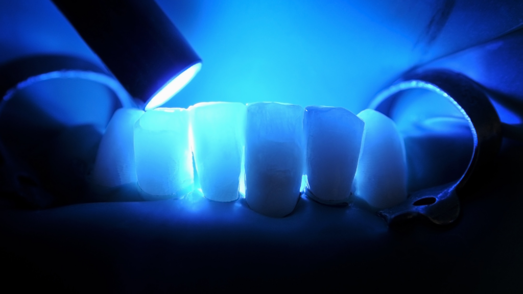 The team analyzed data from over 200 studies to assess 28 composite additives and 17 performance traits, including strength, shrinkage and fracture resistance.