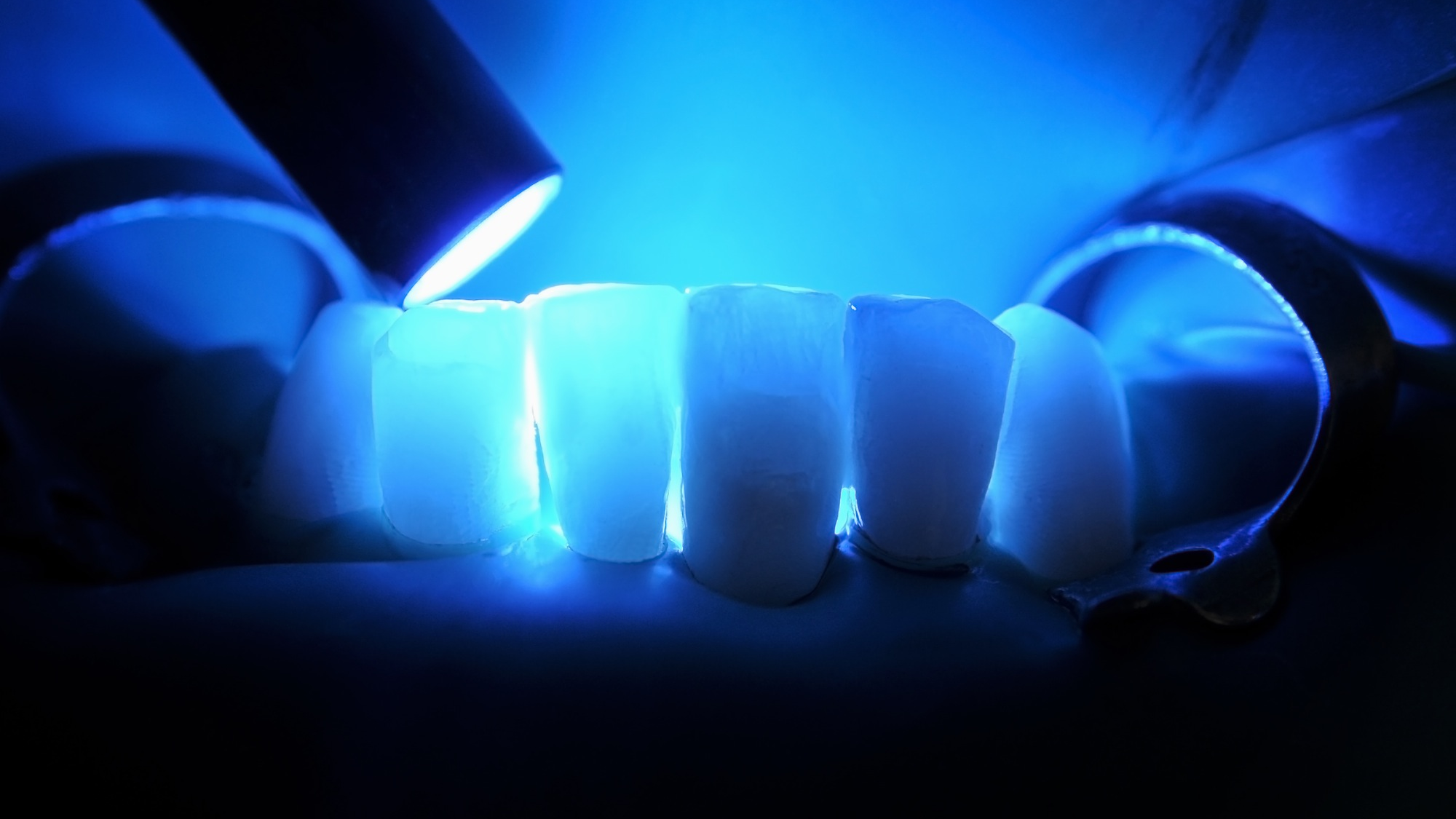 The team analyzed data from over 200 studies to assess 28 composite additives and 17 performance traits, including strength, shrinkage and fracture resistance.