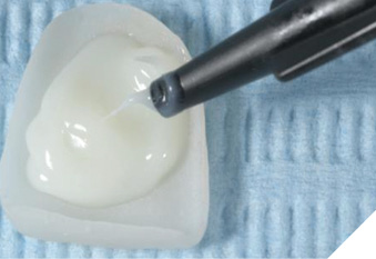 Comfortable handling and targeted application of Variolink Esthetic LC.