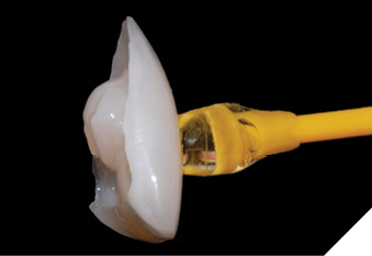 Highly stable consistency of the material (without pressure).