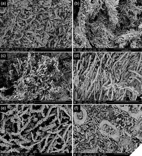 High resolution scanning electron microscopy images on the surfaces of the failed implants. (a, b) The images of the coronal third surfaces of failed implants show abundant rods and spirochetes (a) and bristle-brush formations (b); (c, d) the images of the middle third surface of failed implants show curved rods (vibrios) with flagellas (c) and rods and filaments (d); (e, f) the images of the apical third surfaces of failed implants demonstrate the presence of corn-cob formations with central filament coaggregating with cocci (e) and rods and filaments (f). Images were in 5000x magnification (magnification bar included in each image). (Extracted from Chang et al.(2021))13

