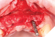 UL2 direction indicator.