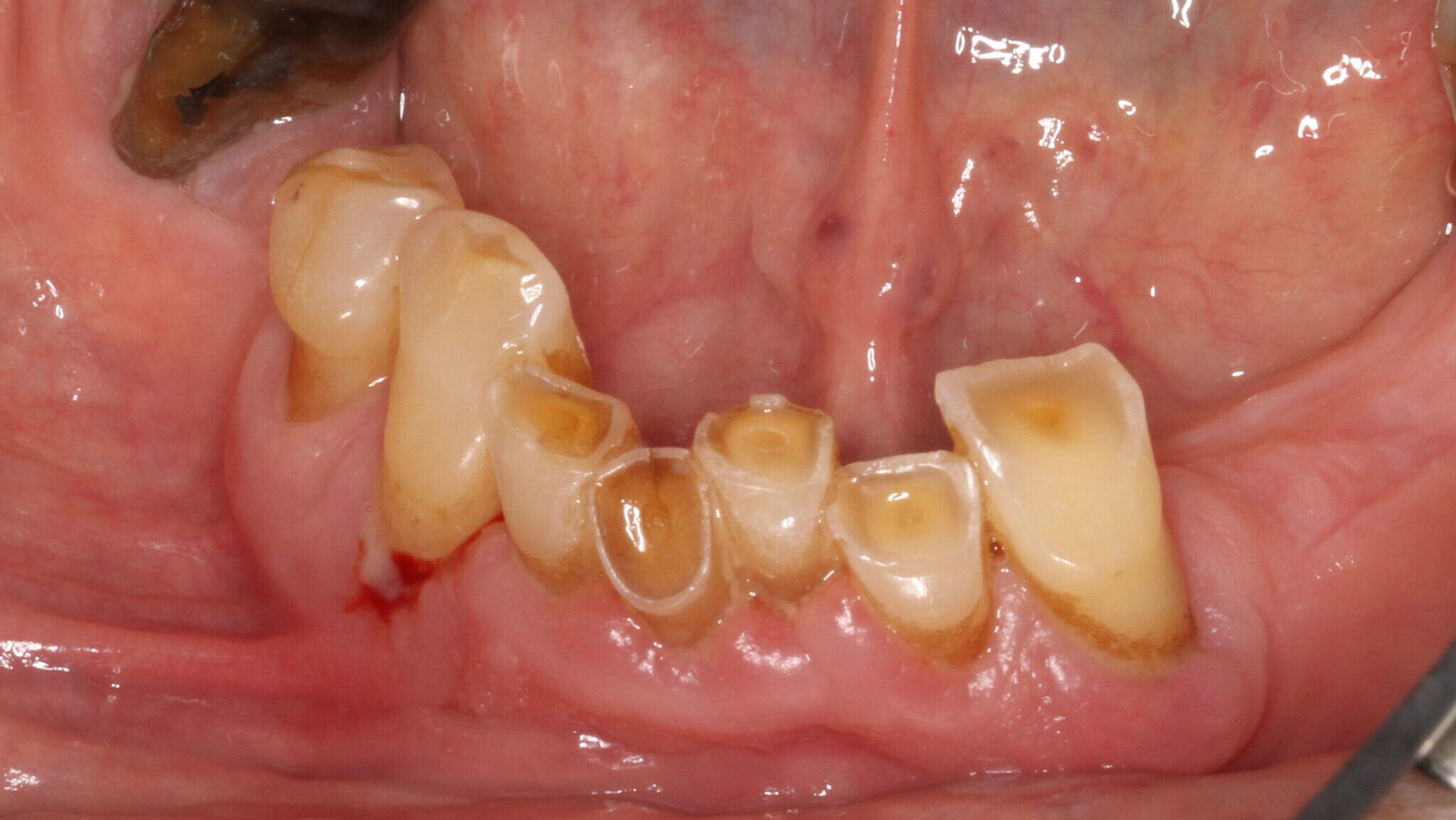 Etiology and management of a common and complex dental problem