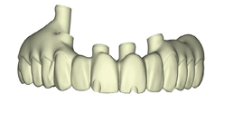 The design proposal of the maxillary and mandibular restoration are sent to the clinician for approval.