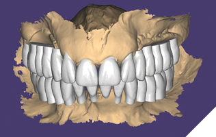 The virtual diagnostic wax-up integrated with extraoral photos is a critical element in determining the treatment plan and potential final outcome.