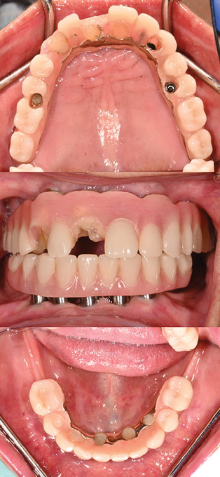 Initial presentation