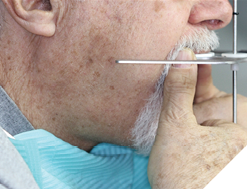 Occlusal plane parallel to the ala-tragal line. 