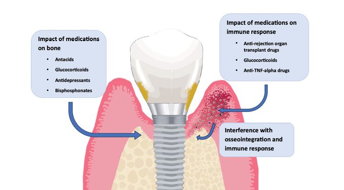 Potential effects of selected medications on peri-implantitis.