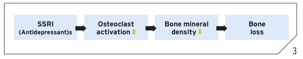 Potential pharmacological mechanisms for reduced osseointegration by SSRIs.