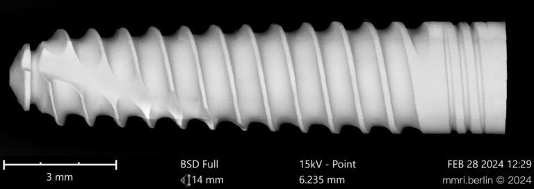  SEM mapping image in high resolution of a clean and residue-free implant.