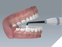 Spot-on curing power, comfort for the patient. Image: SCHOTT.