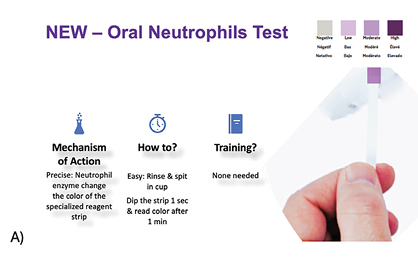PerioMonitor, a biochemical test, was developed so that abnormal levels of oral neutrophils could be quantified chairside.